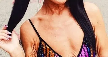 Hastalıkları şansları oldu... Şimdi dünya markaları peşlerinden koşuyor!