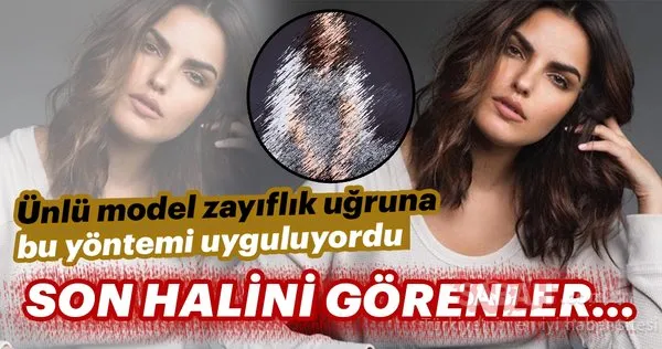 Zayıflık uğruna bu yöntemi uyguluyordu! Son halini görenler...