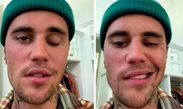 Dünyaca ünlü pop yıldızı Justin Bieber’ın yüz felcinin nedeni ortaya çıktı!