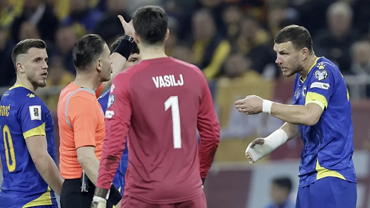 Dzeko'nun burnunda kırık tespit edildi!