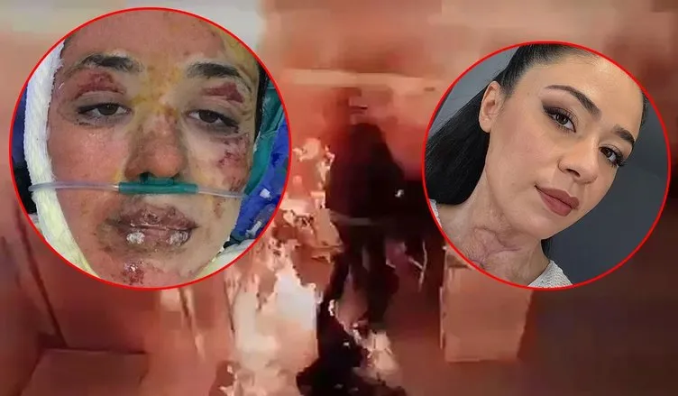 Gizem Hemşire hastanedeki dehşeti anlattı: Yakayım mı sizi dedi ve...