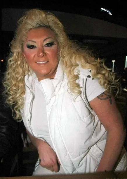 Arabeskin kraliçesi Güllü 70 kilo verdi! 49 yaşındaki Güllü iğne ipliğe döndü! Görenler tanıyamıyor...