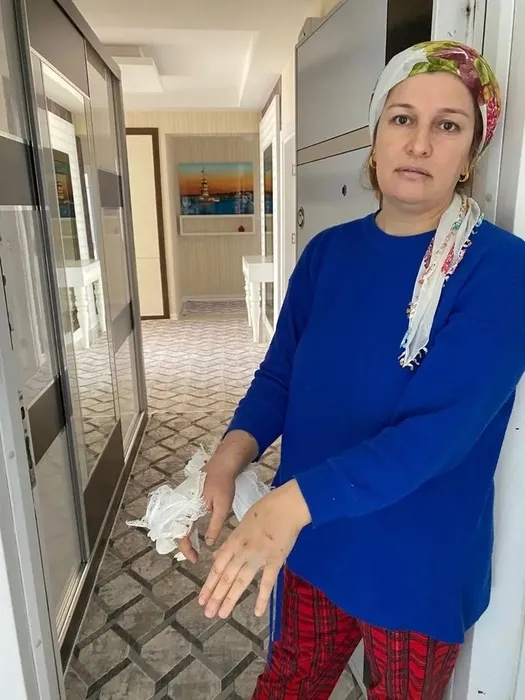 Başıboş köpek dehşeti! Saldırıya uğrayan oğlunu kurtaran anne SABAH’a konuştu: Adeta ellerimle boğuştum