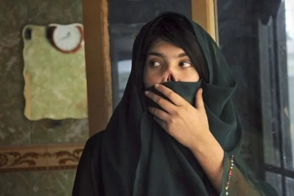 Afganistanlı Ayşe yeni burnuna kavuştu