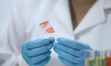 Büyük oranda erkeklerde görülüyor! İşte 17 Nisan Dünya Hemofili Günü...