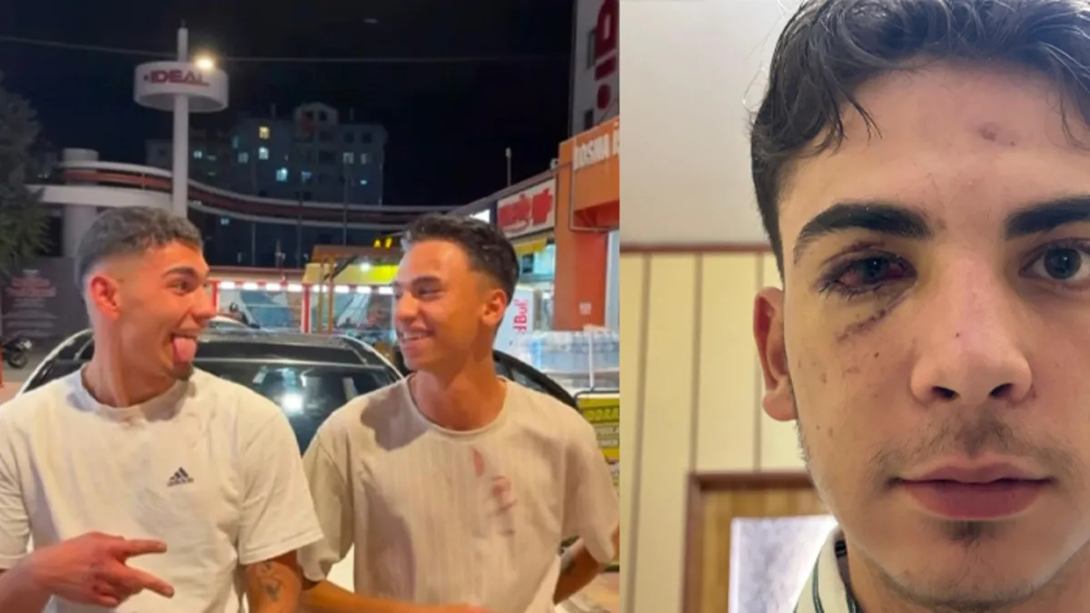 SABAH gündeme getirmişti, Ali’yi kör eden iki zorba yeniden gözaltına alındı SABAH gündeme getirmişti, Ali’yi kör eden iki zorba yeniden gözaltına alındı