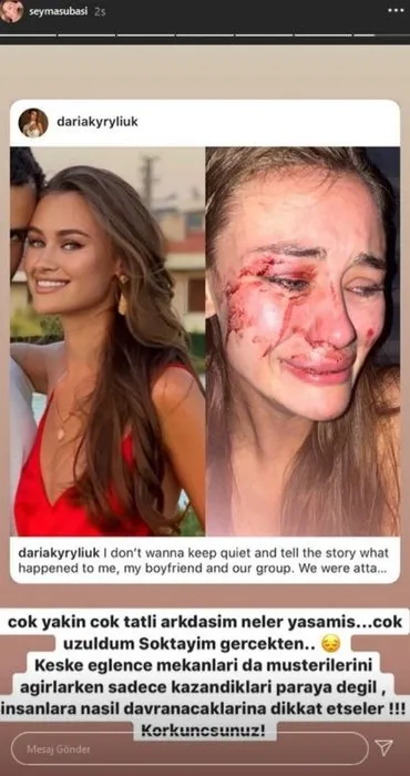 Şeyma Subaşı’nın model arkadaşı saldırıya uğradı! Son Dakika: Model Daria Kyryliuk dehşet görüntülerini paylaştı!