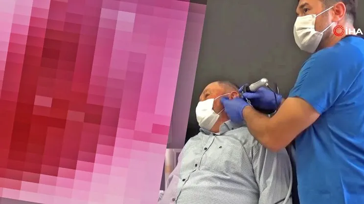 Son dakika haberi: Manisa'da doktorların gözlerine inanamadığı inanılmaz olay! Kulağında canlı olarak... | Video