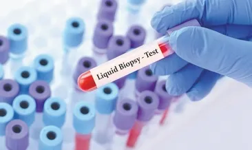 Kanserde likit biyopsi dönemi