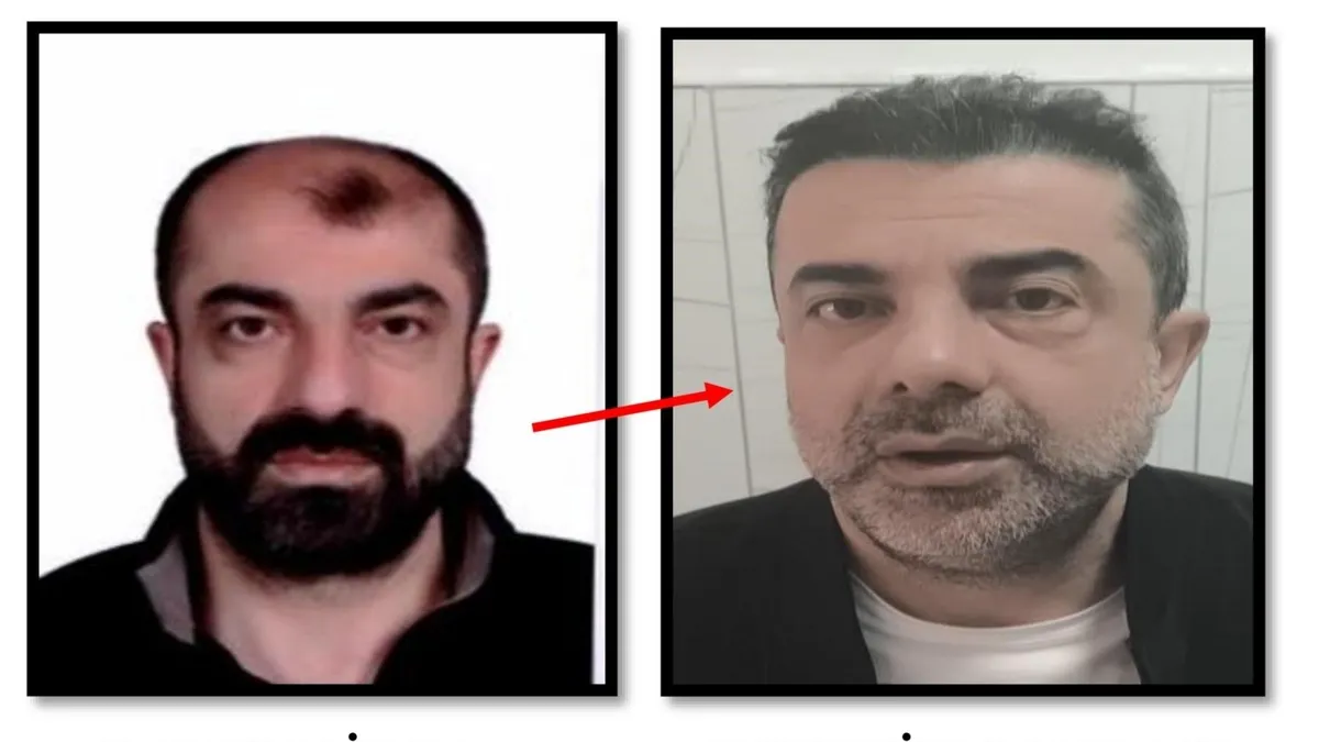 Ankara’da şaşkına çeviren olay! Estetikle kendisini kardeşine benzeten azmettirici yakalandı Ankara’da şaşkına çeviren olay! Estetikle kendisini kardeşine benzeten azmettirici yakalandı