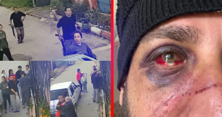 Adana’da eski sevgili dehşeti! 470 bin TL borcunu alamadı üstüne dayak yedi!