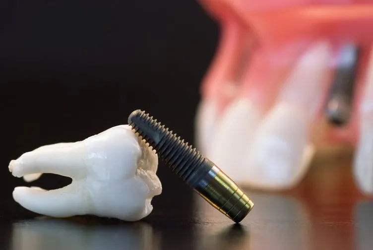 Diş eksikliği birçok hastalığa davetiye çıkarıyor
