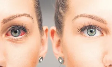 Dünyada 80 milyon kişi glokom