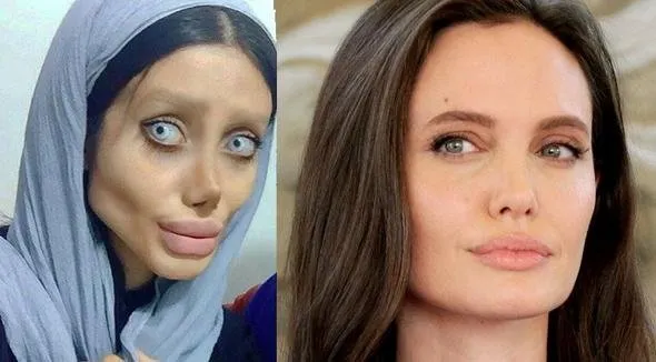 Angelina Jolie olmak istedi; işte şimdi hali!