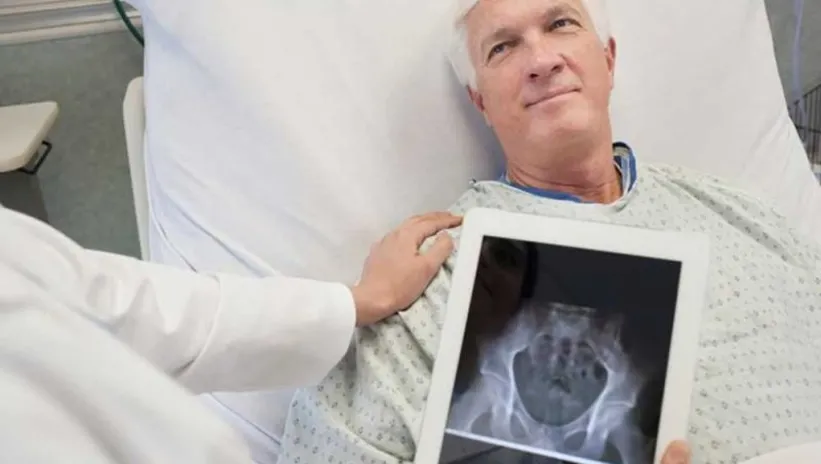 Bu belirtileri asla hafife almayın! Mesane kanseri böyle başlıyor: O kişiler 4 kat risk altında