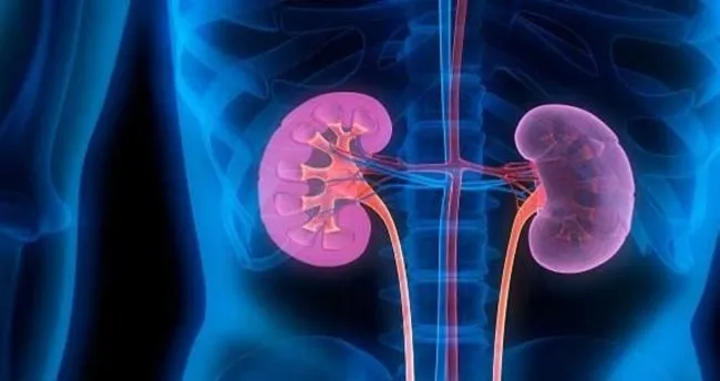 Böbrek Taşı Belirtileri Nelerdir? Böbrek Taşı Belirtileri Nasıl Anlaşılır ve Semptomları Neler?