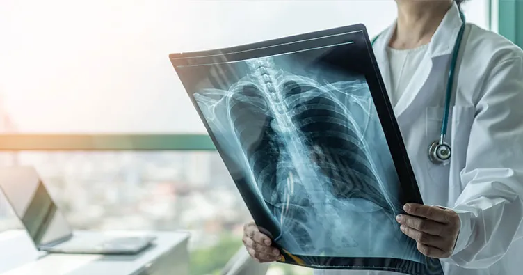 Pnömoni Ne Demek? Tıpta Pnömoni Ne Anlama Gelir, Belirtileri Nelerdir?