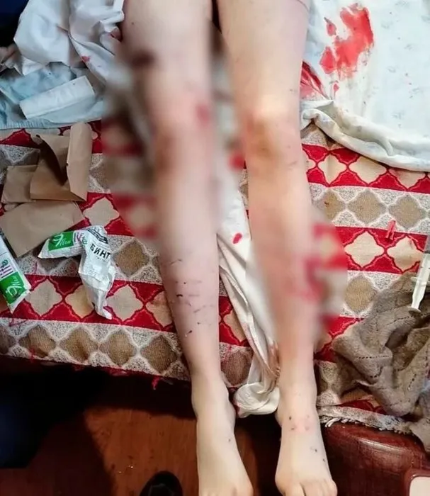 SON DAKİKA HABER Korkunç olay! Bu halde bulundu! Yüzünde sadece