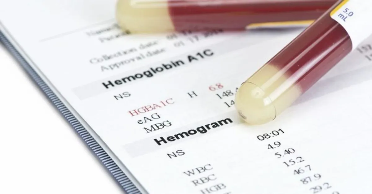 Hemogram nedir? Hemogram testi nasıl yapılır? İşte bilgiler - Sağlık ...