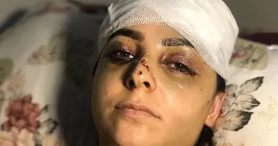 Son dakika haberi: Sultangazi’de talihsiz kadına tayt dayağı: Gözünü hastanede açtı