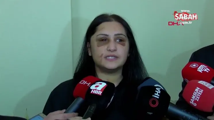 Samsun'da İbrahim Zarap'ın öldüresiye dövdüğü eski eşi Emriye Metoğlu'ndan açıklama | Video