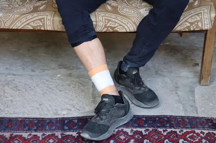 Kapadokya’da korku dolu anlar: Sokak köpekleri Avustralya’lı turiste saldırdı!