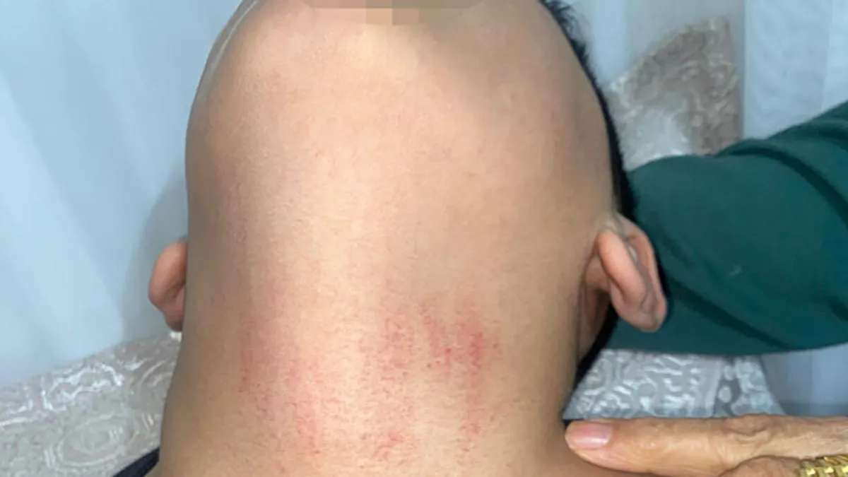 Küçükçekmece’de kadın memurun 10 yaşındaki çocuğu darbettiği iddiası! Küçükçekmece’de kadın memurun 10 yaşındaki çocuğu darbettiği iddiası!