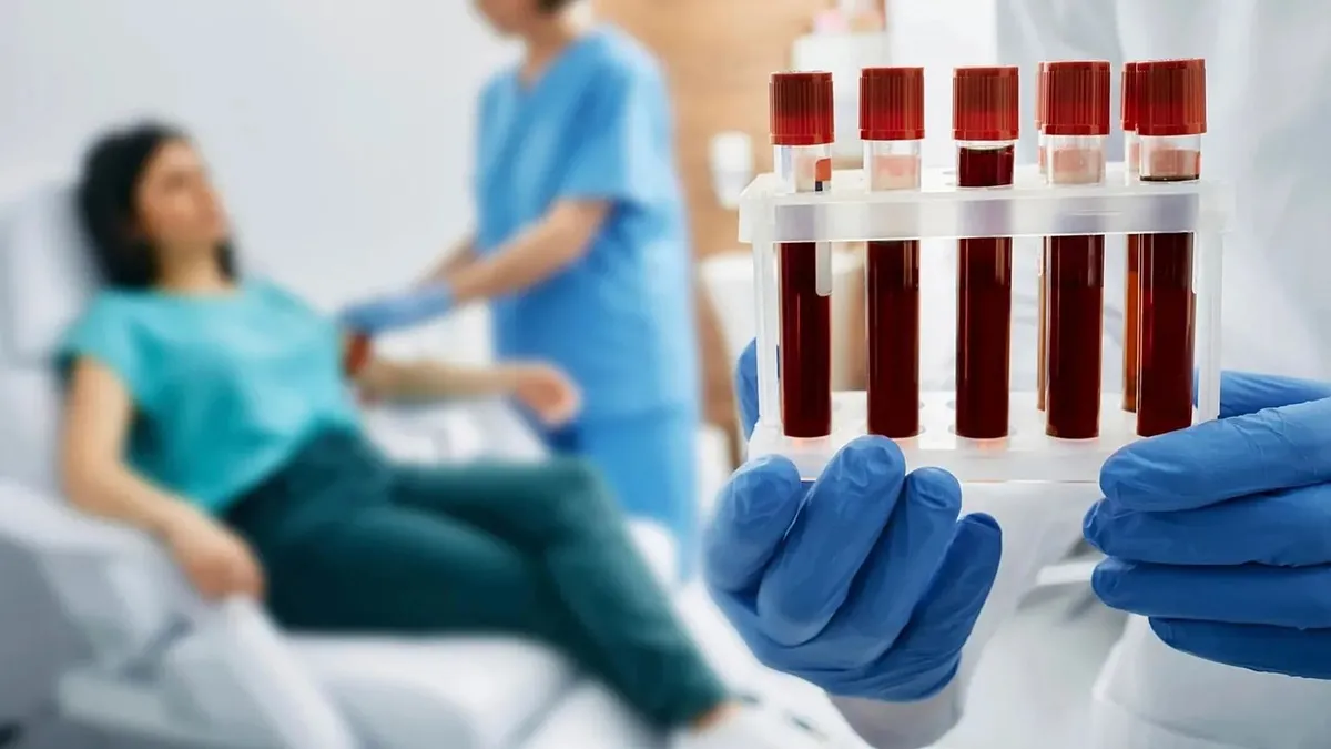 Alzheimer teşhisinde devrim