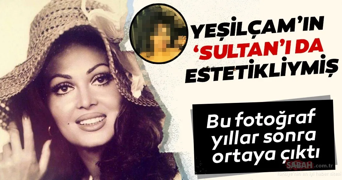 Yeşilçam�ın Sultan�ı Türkan Şoray�ın estetiksiz hali şoke etti! Bu