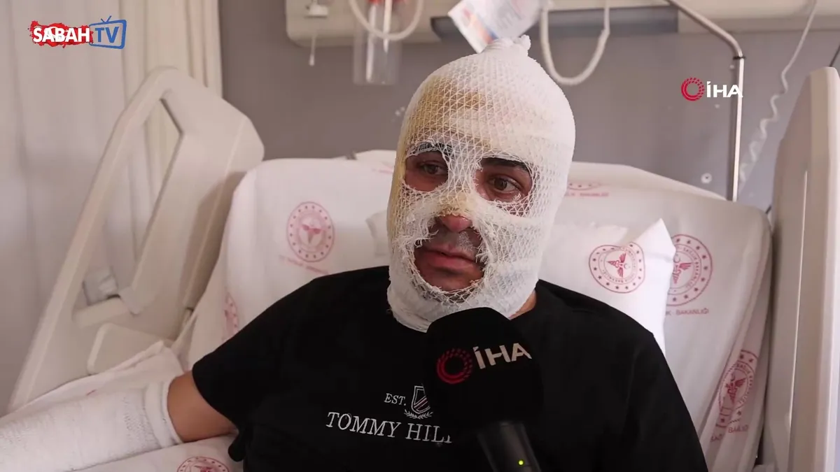Ekmek teknesi küle dönmesin diye mücadele eden esnafın vücudu yaşanan patlamayla yandı videosunu izle Ekmek teknesi küle dönmesin diye mücadele eden esnafın vücudu yaşanan patlamayla yandı videosunu izle