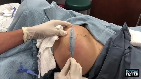 30 yıl boyunca baş ağrısı çekti! Sebebi kan dondurdu