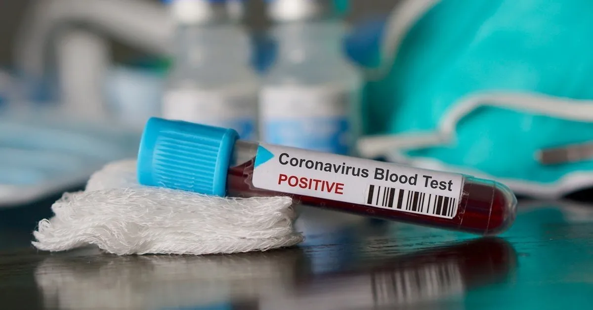 corona virusu testi nasil hangi hastanelerde yapiliyor saglik bakanligi online corona virusu testi nereden yapiliyor ucretsiz mi saglik haberleri