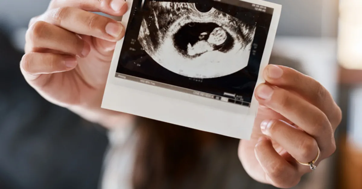 Ultrason Kağıdında Yazan Ao Ne Anlama Gelir? Ultrasonda Ao Ne Demek, Kaç Olmalı? Ultrason Kağıdında Yazan Ao Ne Anlama Gelir? Ultrasonda Ao Ne Demek, Kaç Olmalı?