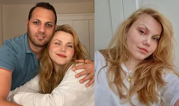 Youtuber Merve Veziroğlu Yıldırım 32 yerinden bıçaklandı! Yaşam savaşı veriyor! Cani koca tutuklandı!