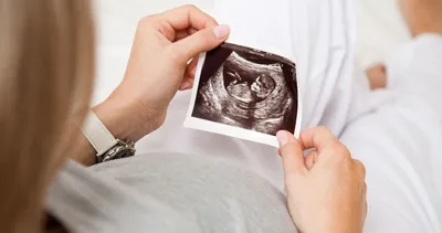 Bebeğinizin cinsiyeti şansa bağlı değil! Ezber bozan araştırmayla uzmanlar gerçekleri ortaya çıkardı