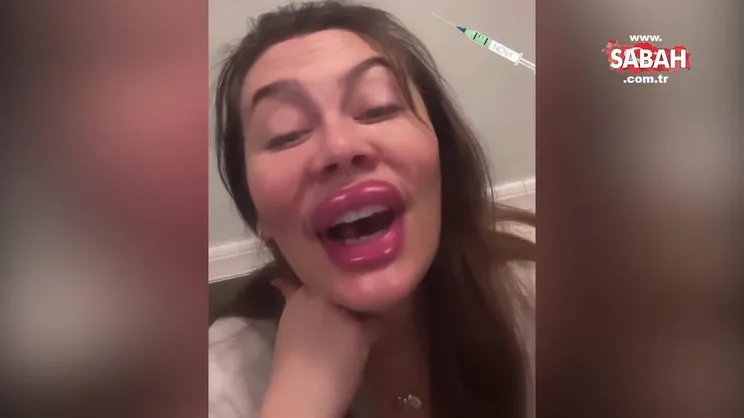 Demet Evgar botoks ve dolguyu fazla kaçıranları böyle ti’ye aldı | Video