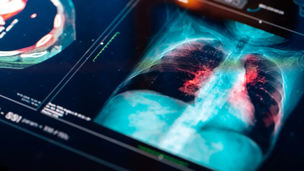 Elektronik sigara kullanımındaki korkunç tablo! Uzmanı uyardı: “5 yaşındaki çocuğun elinde gördüm” Elektronik sigara kullanımındaki korkunç tablo! Uzmanı uyardı: “5 yaşındaki çocuğun elinde gördüm”