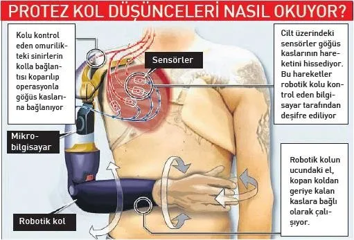 dusunceyle kontrol edilen ilk protez kol gelistirildi a haber son dakika saglik haberleri