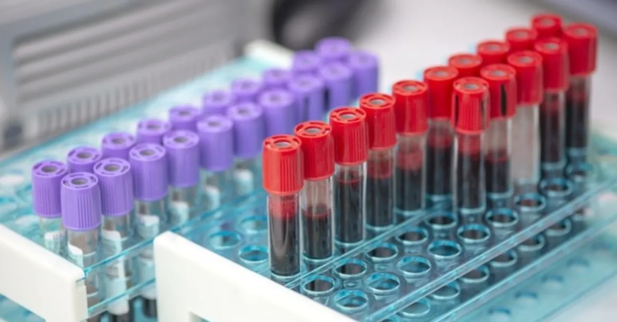 kanda gebelik testinde beta hcg degeri yanlis cikar mi kan tahlili ile gebelik testinin yanlis cikma olasiligi var mi saglik haberleri kanda gebelik testinde beta hcg degeri yanlis cikar mi kan tahlili ile gebelik testinin yanlis cikma olasiligi var mi saglik haberleri