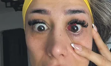 Yediği tavuk kabusu oldu! Tansiyonum o kadar yükselmiş ki gözüm kanlandı