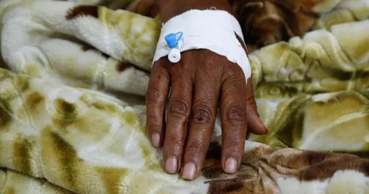 Zimbabve’de kolera salgını nedeniyle 55 kişi hastaneye kaldırıldı