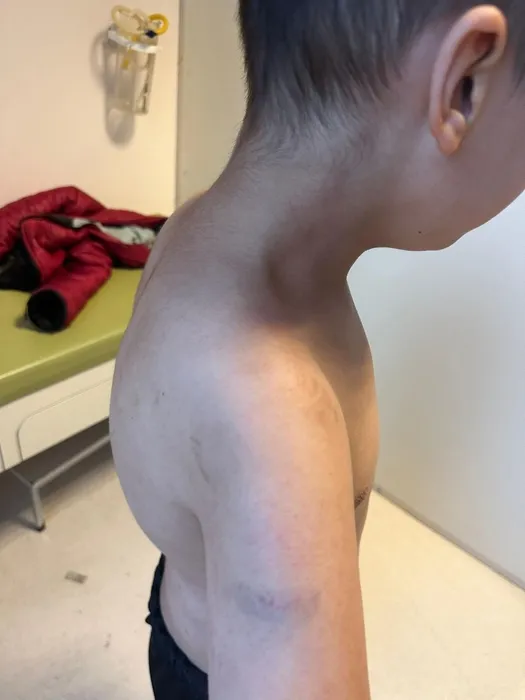 Özel bakım merkezinde otizmli çocuğa şiddet: Vücudu morardı! Beğenmiyorsanız kendiniz baksaydınız!