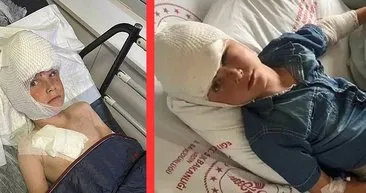 Mardin’de köpek dehşeti: 7 yaşındaki Bilal başından ve kolundan yaralandı!