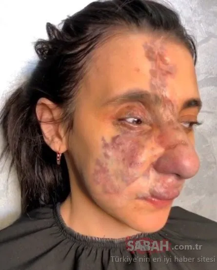 Öyle bir değişti ki....Son haline kendisi bile inanamadı!