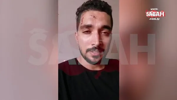 İsrail saldırısı sonrası yaralanan Gazzeli Gazeteci Saeb Al Zard'dan sabah.com.tr aracılığı ile mesaj: 