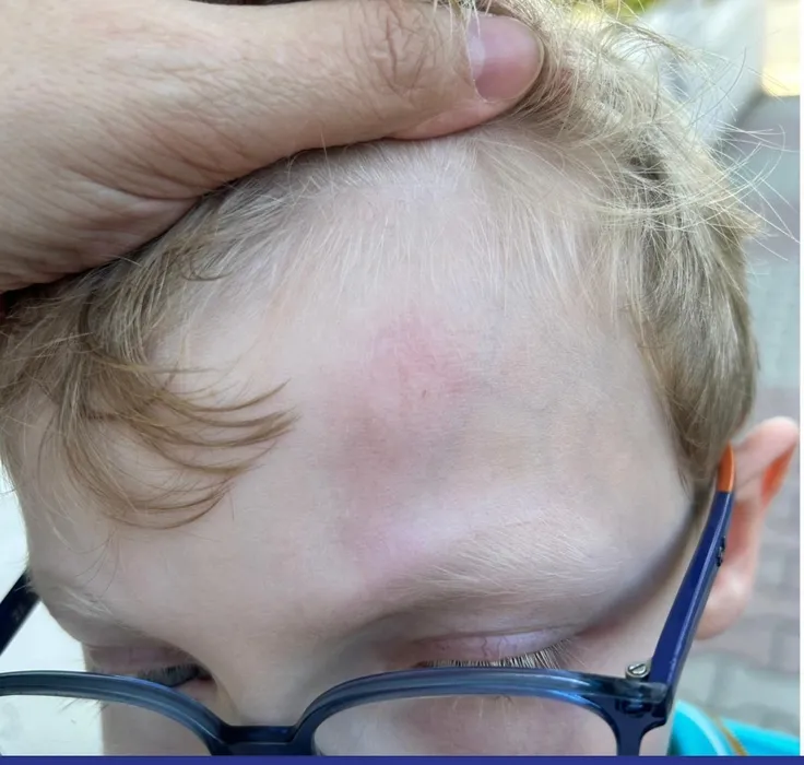 SON DAKİKA... İstanbul’da 7 yaşındaki çocuğa demir çubuklu dayak: Oğlun çok ağlıyor okula gel!