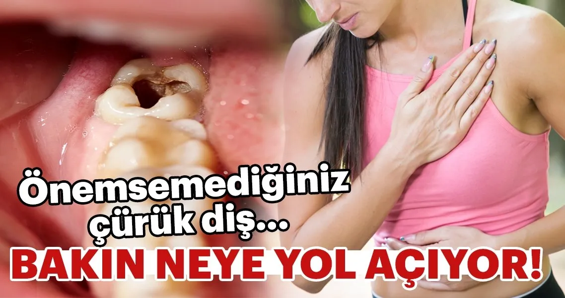 onemsemediginiz curuk dis bakin neye