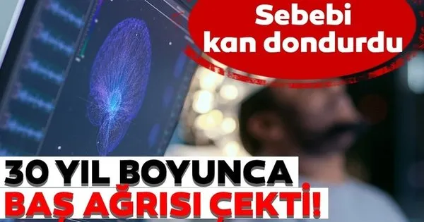 30 yıl boyunca baş ağrısı çekti! Sebebi kan dondurdu