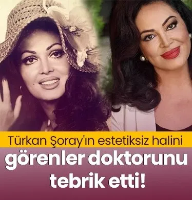 Türkan Şoray’ın estetiksiz halini görenler doktorunu tebrik etti! Meğer doğal güzel değilmiş!