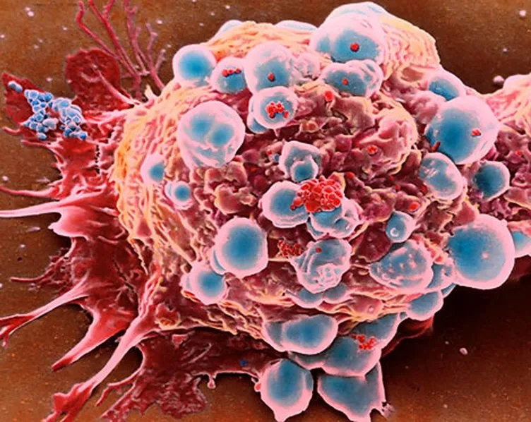 Bilim insanları kanseri önleyip yaşamı uzatan ilaç keşfetti!
